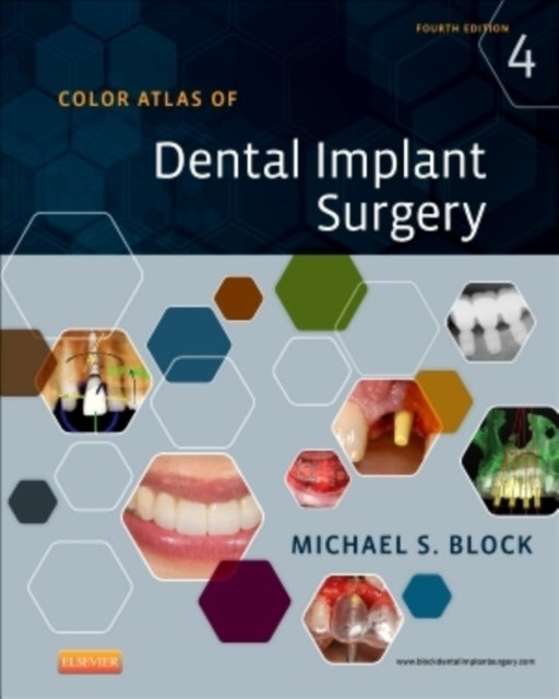 Book cover of: Color Atlas of Dental Implant Surgery. By: Michael S. Block DMD