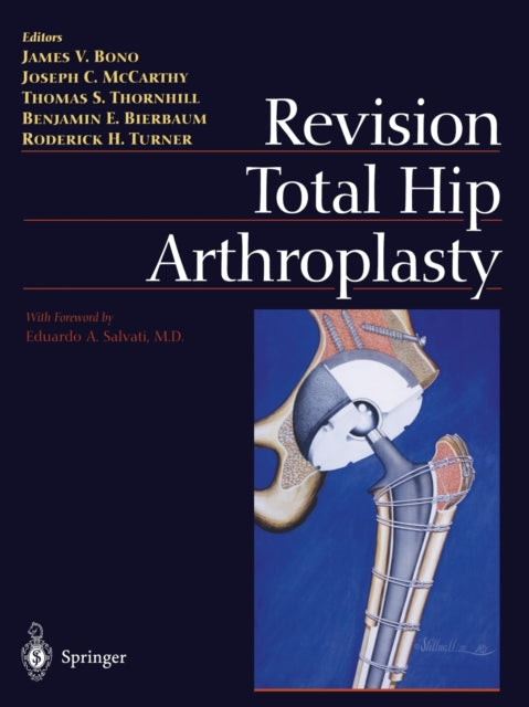 Book cover of: Revision Total Hip Arthroplasty. By: James V. Bono