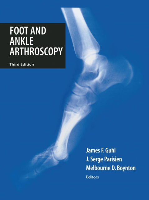 Book cover of: Foot and Ankle Arthroscopy. By: James F. Guhl