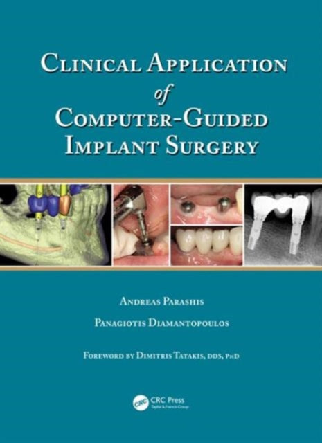 Book cover of: Clinical Application of Computer-Guided Implant Surgery. By: Panagiotis Diamantopoulos