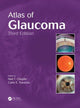 Book cover of: Atlas of Glaucoma