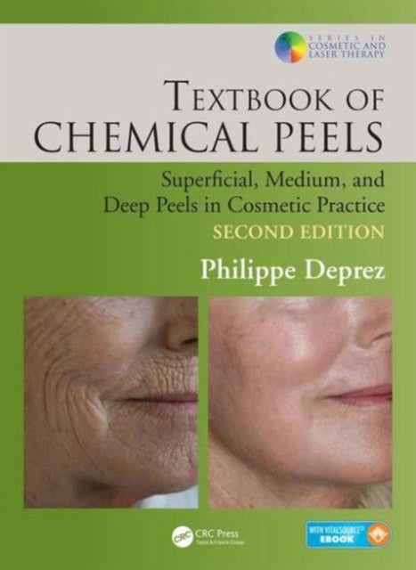 Book cover of: Textbook of Chemical Peels. By: Philippe Deprez