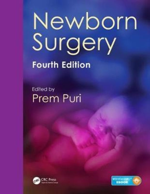 Book cover of: Newborn Surgery. By: Prem Puri