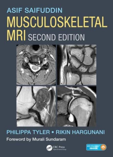 Book cover of: Musculoskeletal MRI. By: Asif Saifuddin