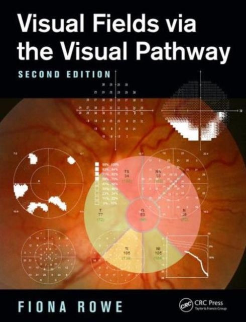 Book cover of: Visual Fields via the Visual Pathway. By: Fiona Rowe