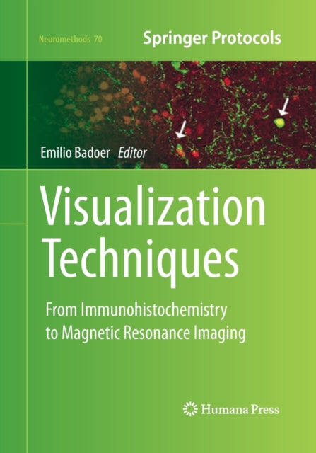 Book cover of: Visualization Techniques. By: Emilio Badoer