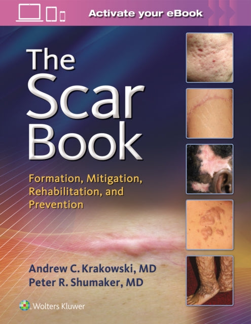 Book cover of: Scar Book. By: Dr. Andrew C. Krakowski