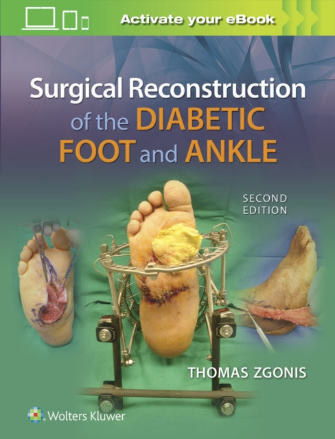 Book cover of: Surgical Reconstruction of the Diabetic Foot and Ankle. By: Thomas Zgonis DPM  FACFAS