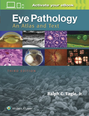 Eye Pathology