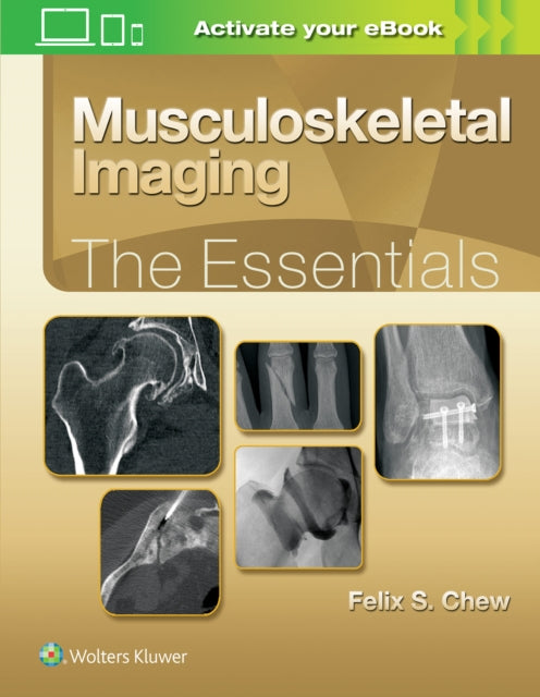 Book cover of: Musculoskeletal Imaging: The Essentials. By: Felix S. Chew MD