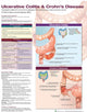Book cover of: Ulcerative Colitis & Crohn's Disease Anatomical Chart Laminated