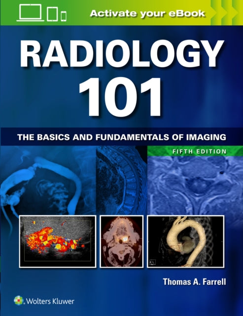 Book cover of: Radiology 101. By: Smith