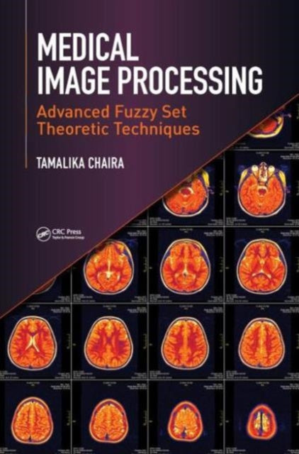 Book cover of: Medical Image Processing. By: Tamalika Chaira