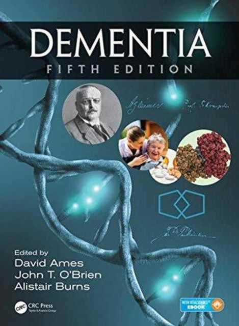 Book cover of: Dementia. By: David Ames