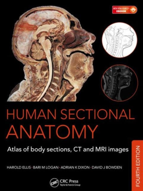 Book cover of: Human Sectional Anatomy. By: Adrian K. Dixon