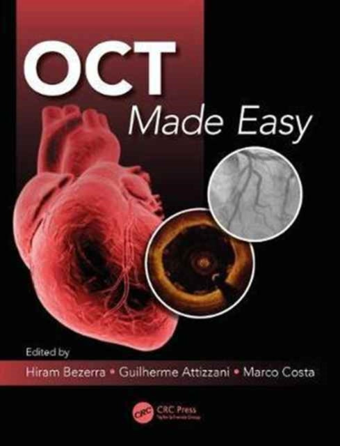 Book cover of: OCT Made Easy. By: Guilherme F. Attizzani