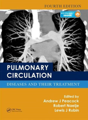 Pulmonary Circulation