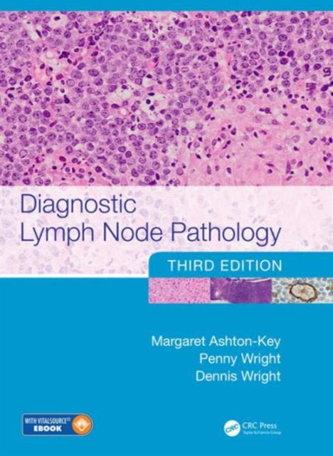 Book cover of: Diagnostic Lymph Node Pathology. By: Margaret Ashton-Key