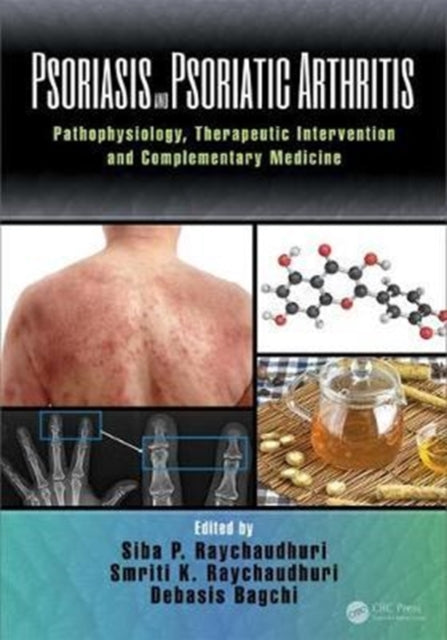 Book cover of: Psoriasis and Psoriatic Arthritis. By: Siba P. Raychaudhuri