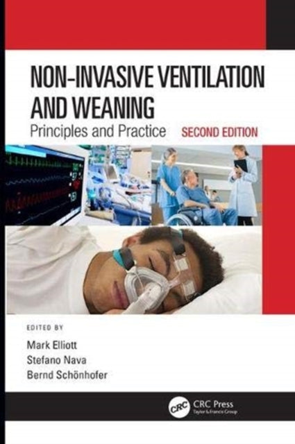 Book cover of: Non-Invasive Ventilation and Weaning. By: Mark Elliott