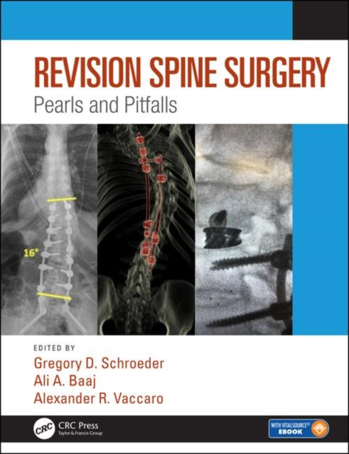 Book cover of: Revision Spine Surgery. By: Alexander R. Vaccaro