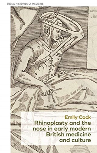 Book cover of: Rhinoplasty and the Nose in Early Modern British Medicine and Culture. By: Emily Cock