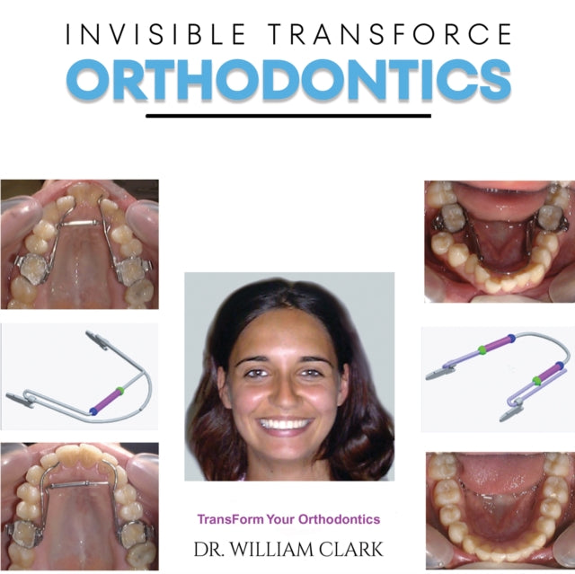 Book cover of: Invisible TransForce Orthodontics