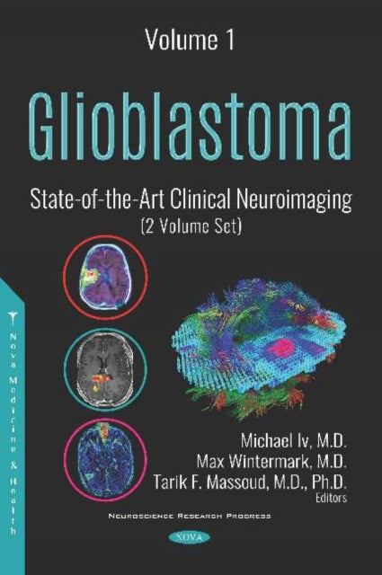 Book cover of: Glioblastoma. By: Michael Iv