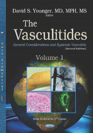 Vasculitides