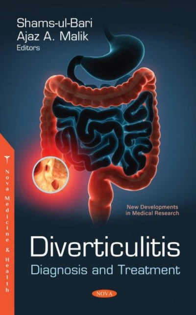 Book cover of: Diverticulitis. By: Shams-ul-Bari