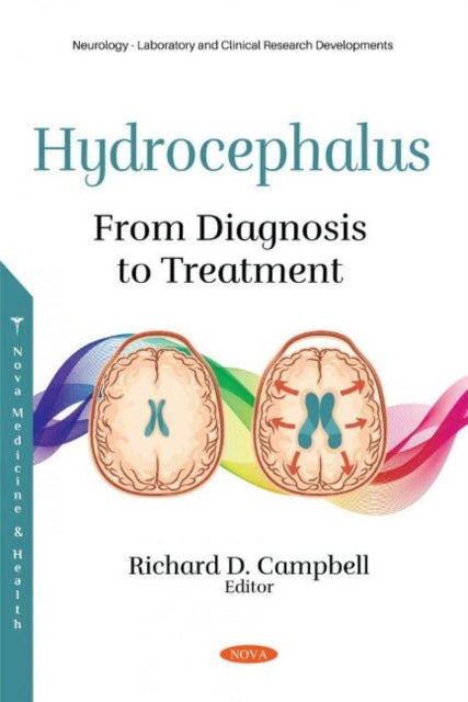 Book cover of: Hydrocephalus. By: Richard D. Campbell