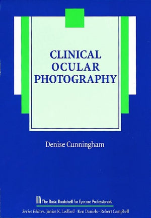 Clinical Ocular Photography