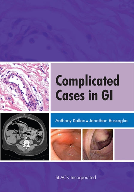 Book cover of: Complicated Cases in GI