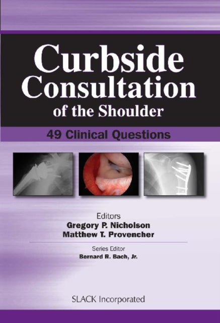 Book cover of: Curbside Consultation of the Shoulder. By: Gregory Nicholson