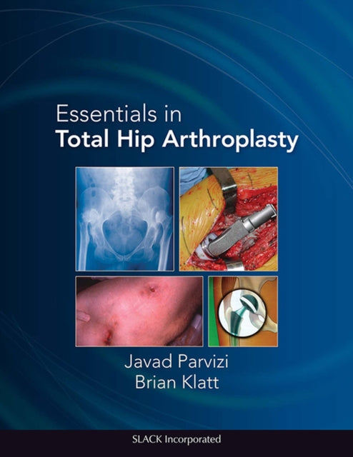Book cover of: Essentials in Total Hip Arthroplasty