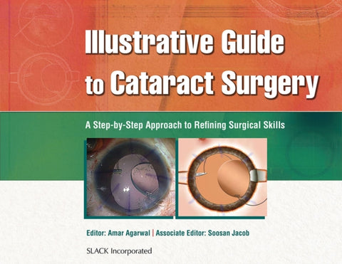 Illustrative Guide to Cataract Surgery