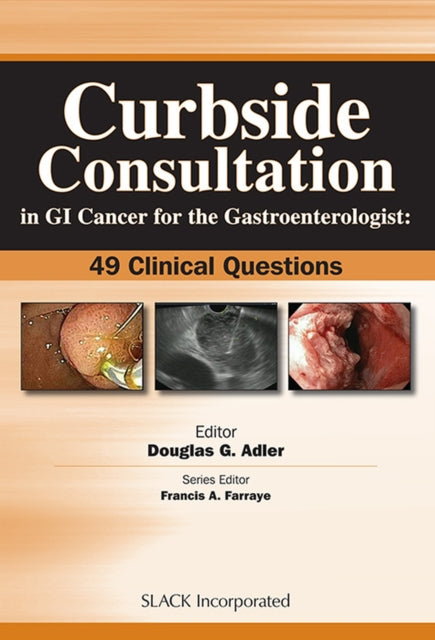 Book cover of: Curbside Consultation in GI Cancer for the Gastroenterologist. By: Douglas Adler