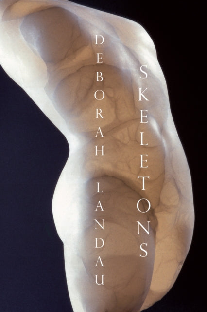 Book cover of: Skeletons. By: Deborah Landau