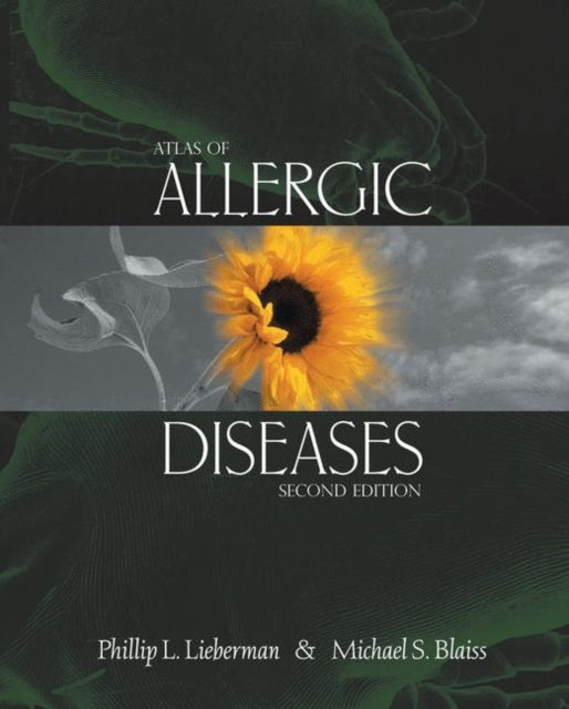 Book cover of: Atlas of Allergic Diseases