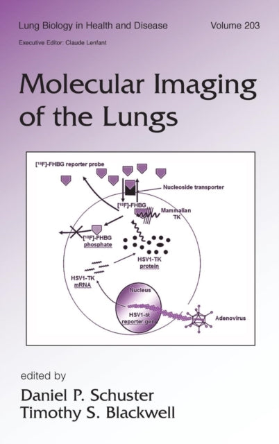 Book cover of: Molecular Imaging of the Lungs