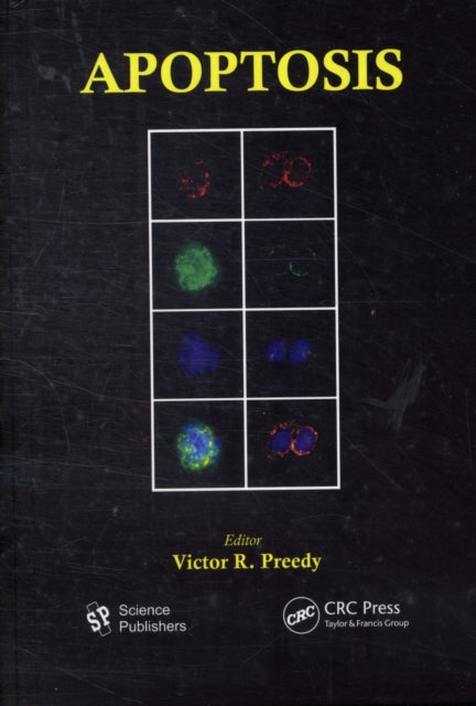 Apoptosis