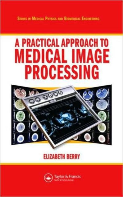 Book cover of: Practical Approach to Medical Image Processing. By: Elizabeth Berry