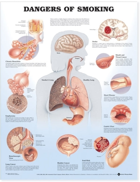 Book cover of: Dangers of Smoking Anatomical Chart. By: Anatomical Chart Company