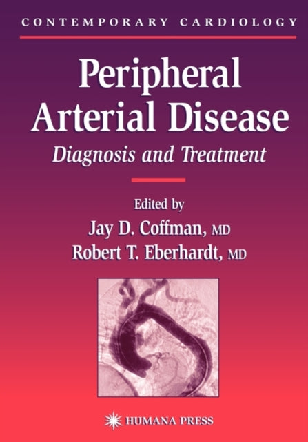 Book cover of: Peripheral Arterial Disease