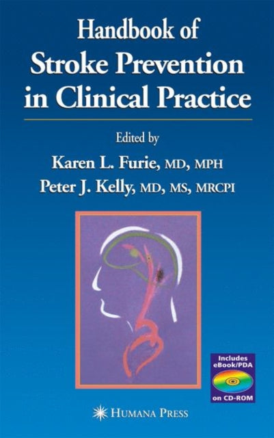 Book cover of: Handbook of Stroke Prevention in Clinical Practice