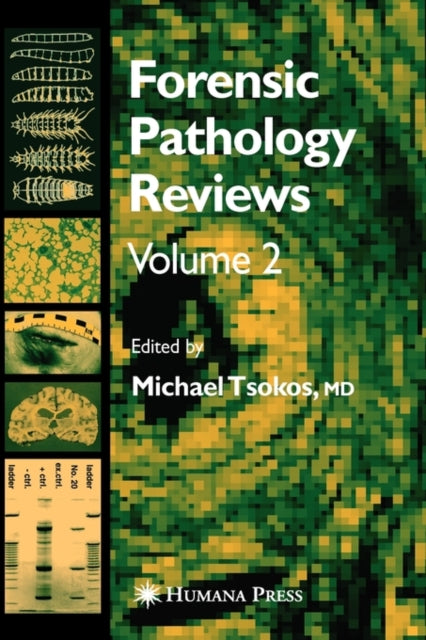 Forensic Pathology Reviews Vol 2