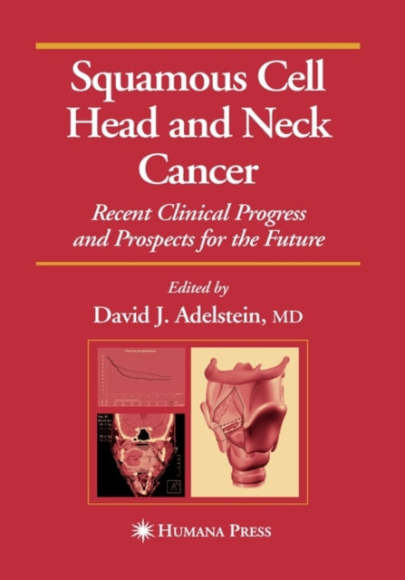 Book cover of: Squamous Cell Head and Neck Cancer. By: David J. Adelstein