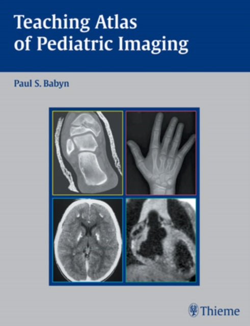 Book cover of: Teaching Atlas of Pediatric Imaging