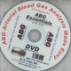 Book cover of: ABG -- Arterial Blood Gas Analysis Made Easy DVD