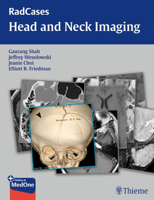 Book cover of: RadCases Head and Neck Imaging. By: Jeffrey Wesolowski